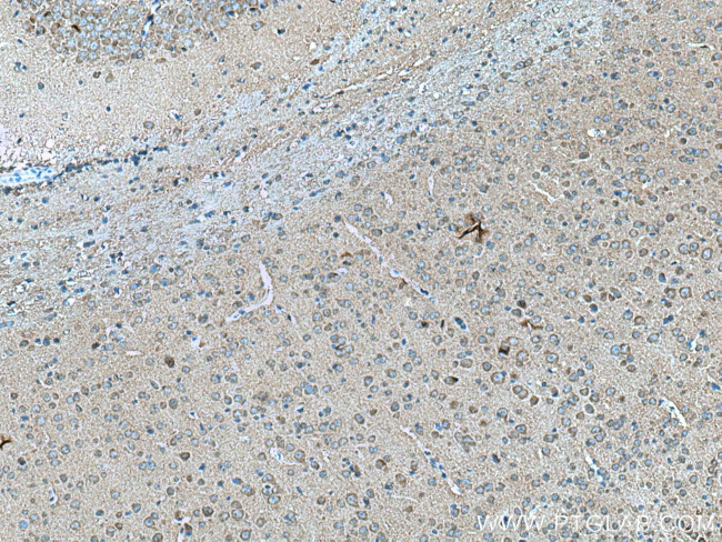 NTM Antibody in Immunohistochemistry (Paraffin) (IHC (P))