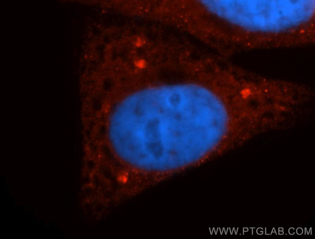 Casein Kinase 1 delta Antibody in Immunocytochemistry (ICC/IF)