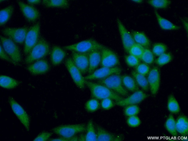 GALE Antibody in Immunocytochemistry (ICC/IF)