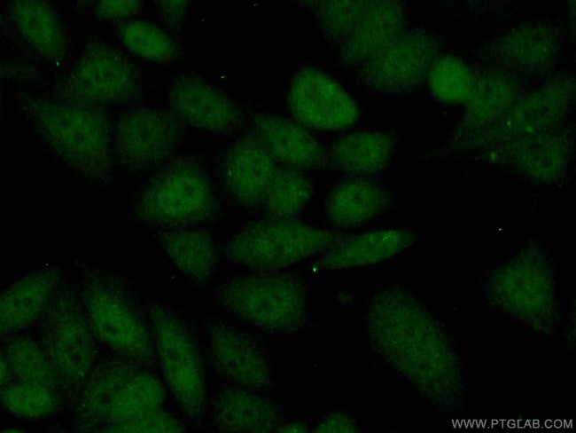 KDM5C Antibody in Immunocytochemistry (ICC/IF)