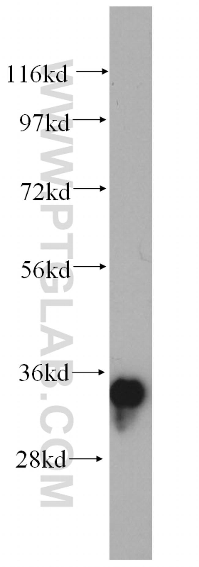 AMPK beta 2 Antibody in Western Blot (WB)