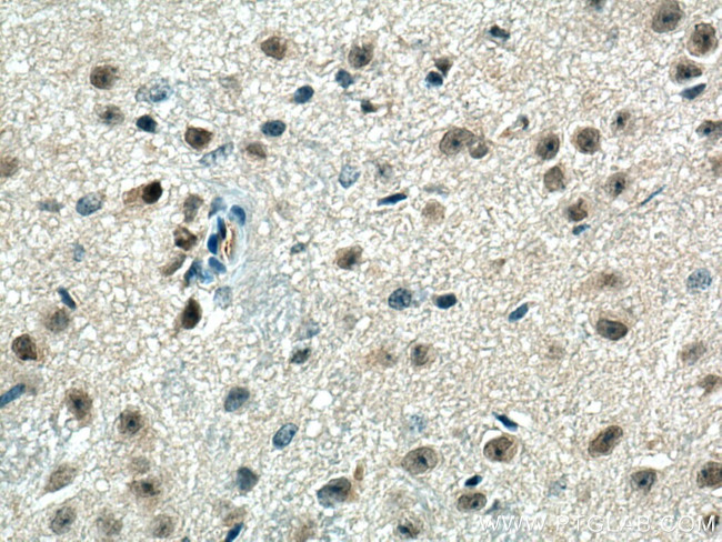 PPME1 Antibody in Immunohistochemistry (Paraffin) (IHC (P))