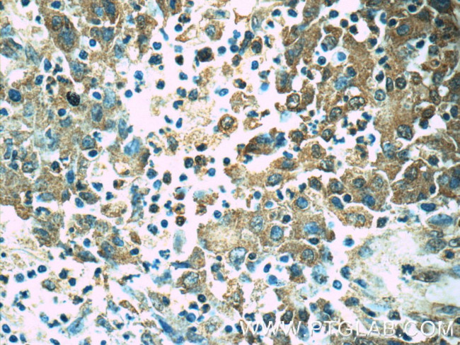 Orai1-Alpha Antibody in Immunohistochemistry (Paraffin) (IHC (P))