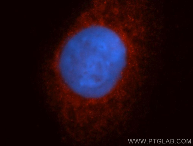 CYP17A1 Antibody in Immunocytochemistry (ICC/IF)