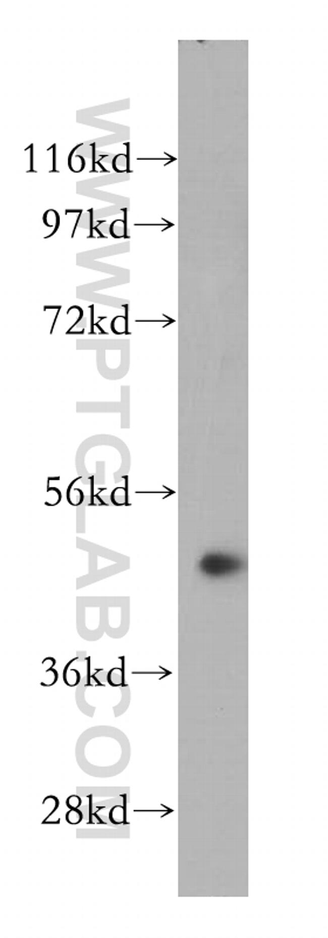 NOB1 Antibody in Western Blot (WB)