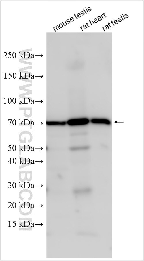 UGT1A10 Antibody in Western Blot (WB)