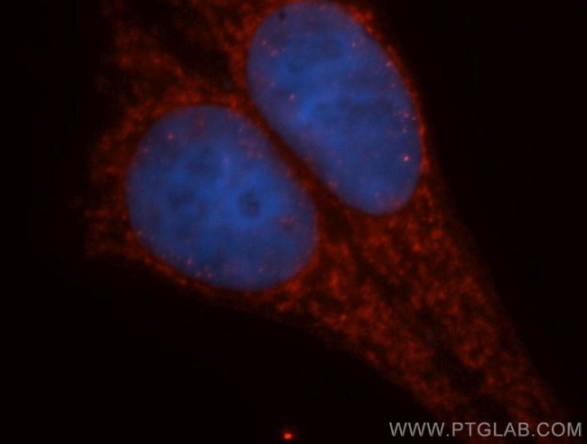 GLUD2 Antibody in Immunocytochemistry (ICC/IF)