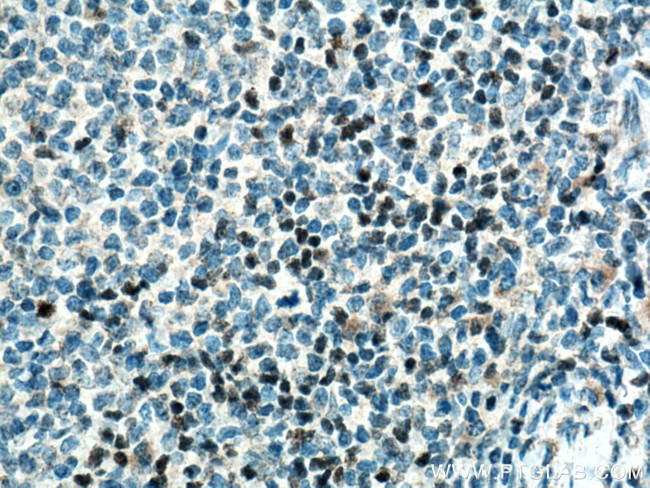TCF7 Antibody in Immunohistochemistry (Paraffin) (IHC (P))