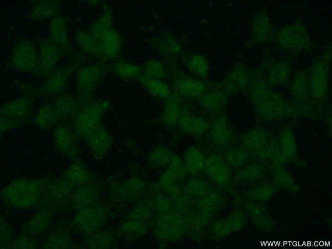 SMC6 Antibody in Immunocytochemistry (ICC/IF)