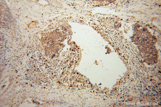 AIG1 Antibody in Immunohistochemistry (Paraffin) (IHC (P))