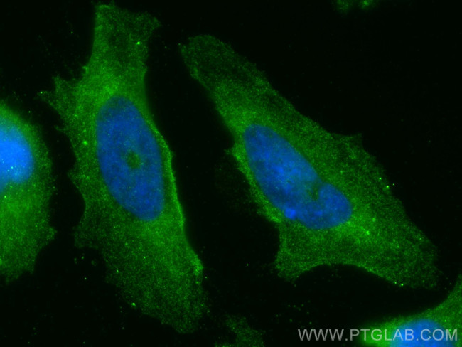 EPN1 Antibody in Immunocytochemistry (ICC/IF)