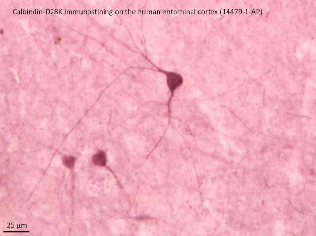 Calbindin-D28k Antibody in Immunohistochemistry (Paraffin) (IHC (P))