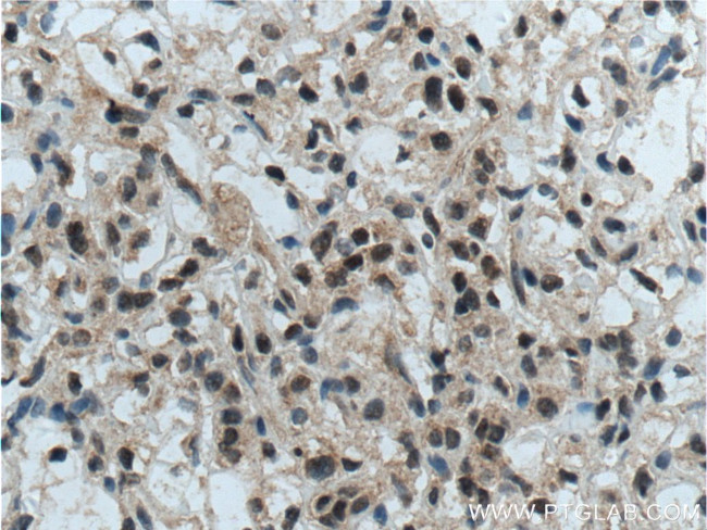 TFE3 Antibody in Immunohistochemistry (Paraffin) (IHC (P))