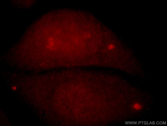 C9orf78 Antibody in Immunocytochemistry (ICC/IF)