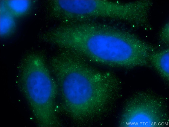 CREB3L2 Antibody in Immunocytochemistry (ICC/IF)