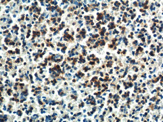 PTPN5 Antibody in Immunohistochemistry (Paraffin) (IHC (P))