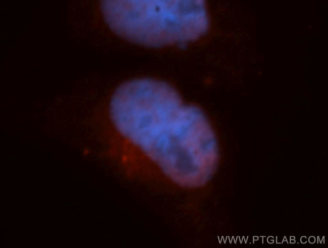 CARD8 Antibody in Immunocytochemistry (ICC/IF)