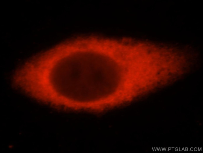 USP14 Antibody in Immunocytochemistry (ICC/IF)
