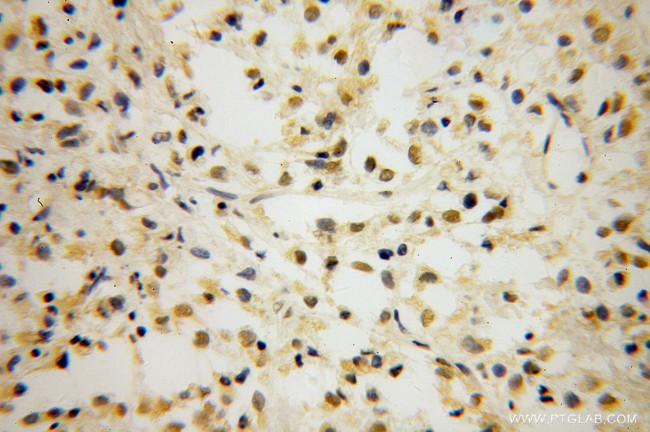 TCF7L1 Antibody in Immunohistochemistry (Paraffin) (IHC (P))