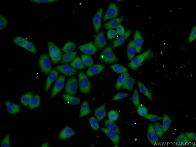 UBC12 Antibody in Immunocytochemistry (ICC/IF)