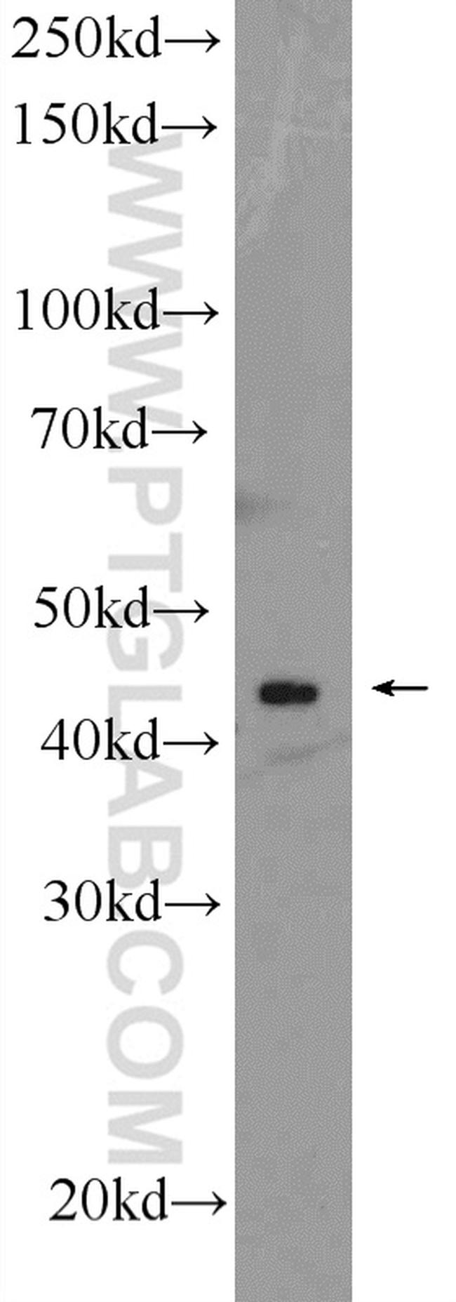 DYX1C1 Antibody in Western Blot (WB)