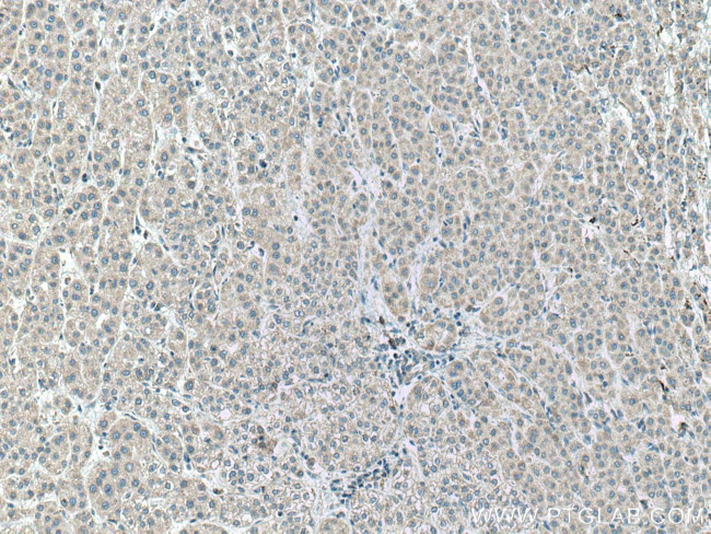 ACADVL Antibody in Immunohistochemistry (Paraffin) (IHC (P))