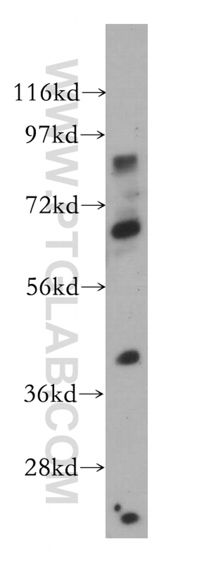 ZNF410 Antibody in Western Blot (WB)