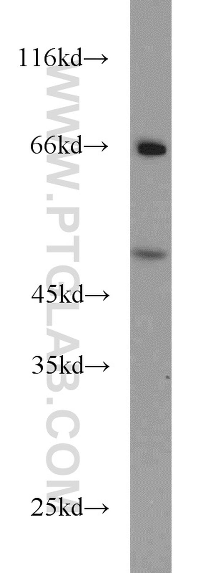 RELT Antibody in Western Blot (WB)