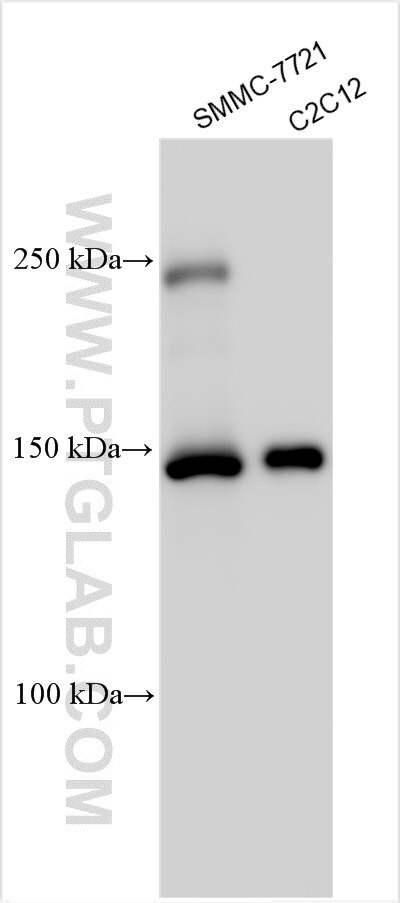 CASZ1 Antibody in Western Blot (WB)