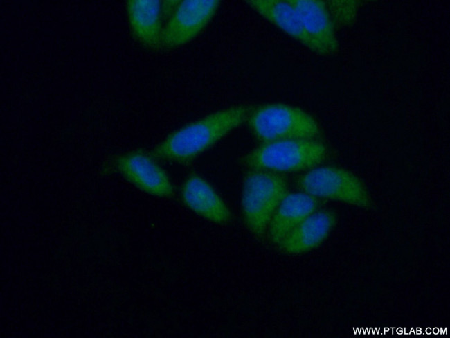 MLL5 Antibody in Immunocytochemistry (ICC/IF)