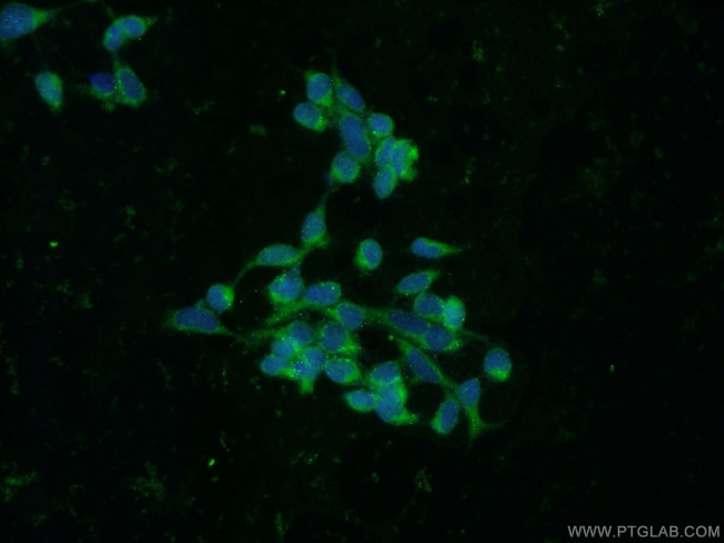 RBP7 Antibody in Immunocytochemistry (ICC/IF)