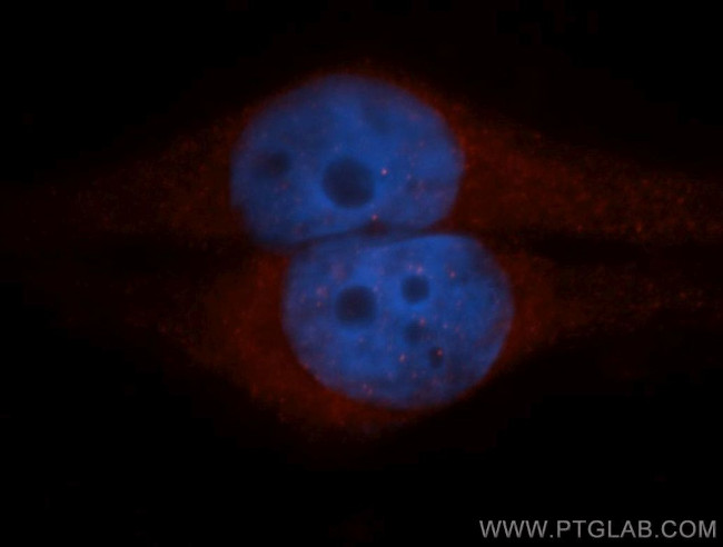 CLIC1 Antibody in Immunocytochemistry (ICC/IF)