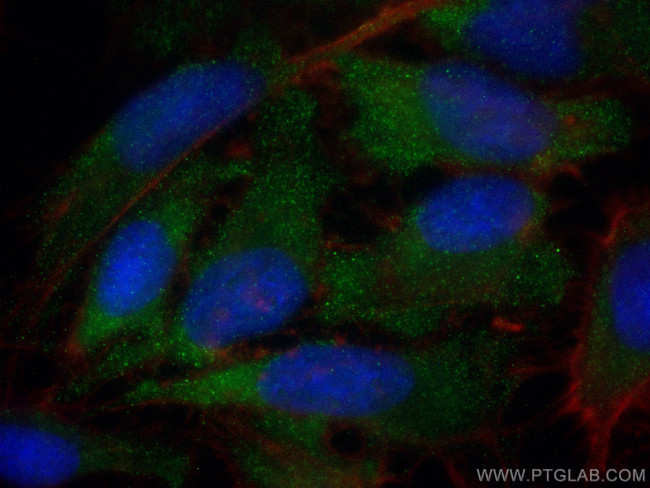 LDHC Antibody in Immunocytochemistry (ICC/IF)