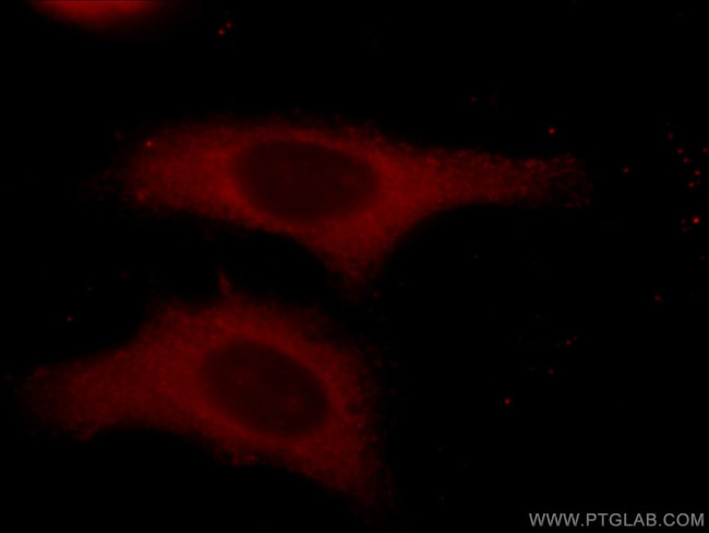 alpha Tubulin Antibody in Immunocytochemistry (ICC/IF)