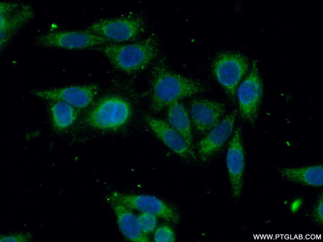 GSTO2 Antibody in Immunocytochemistry (ICC/IF)