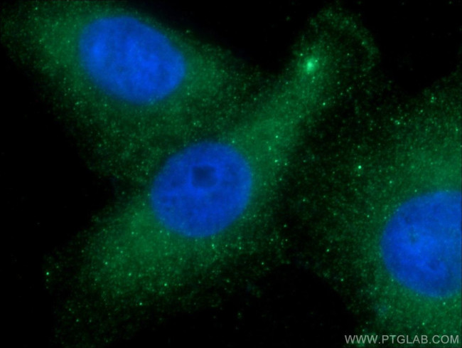 CDR2L Antibody in Immunocytochemistry (ICC/IF)