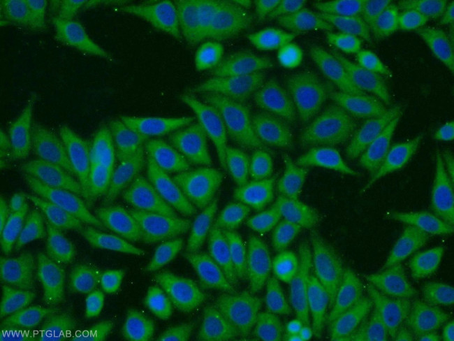 RINT1 Antibody in Immunocytochemistry (ICC/IF)