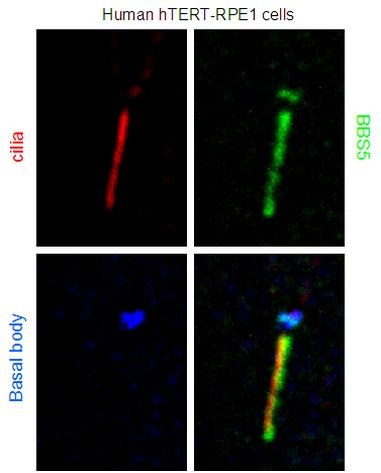 BBS5 Antibody in Immunocytochemistry (ICC/IF)