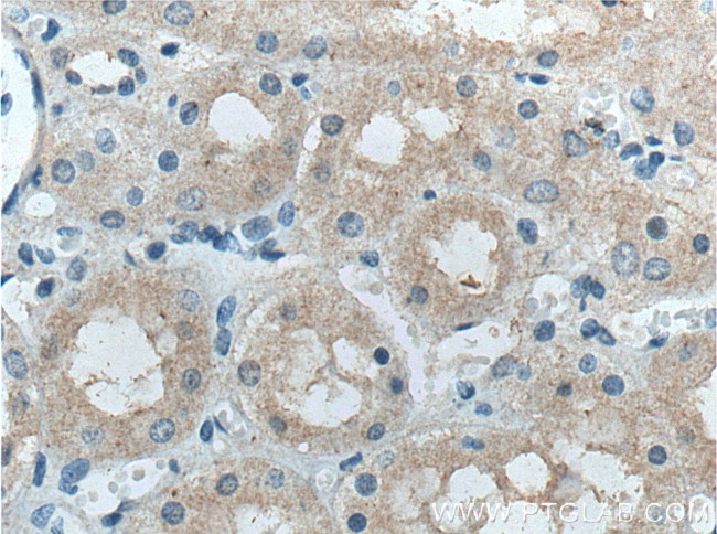 FBXO27 Antibody in Immunohistochemistry (Paraffin) (IHC (P))