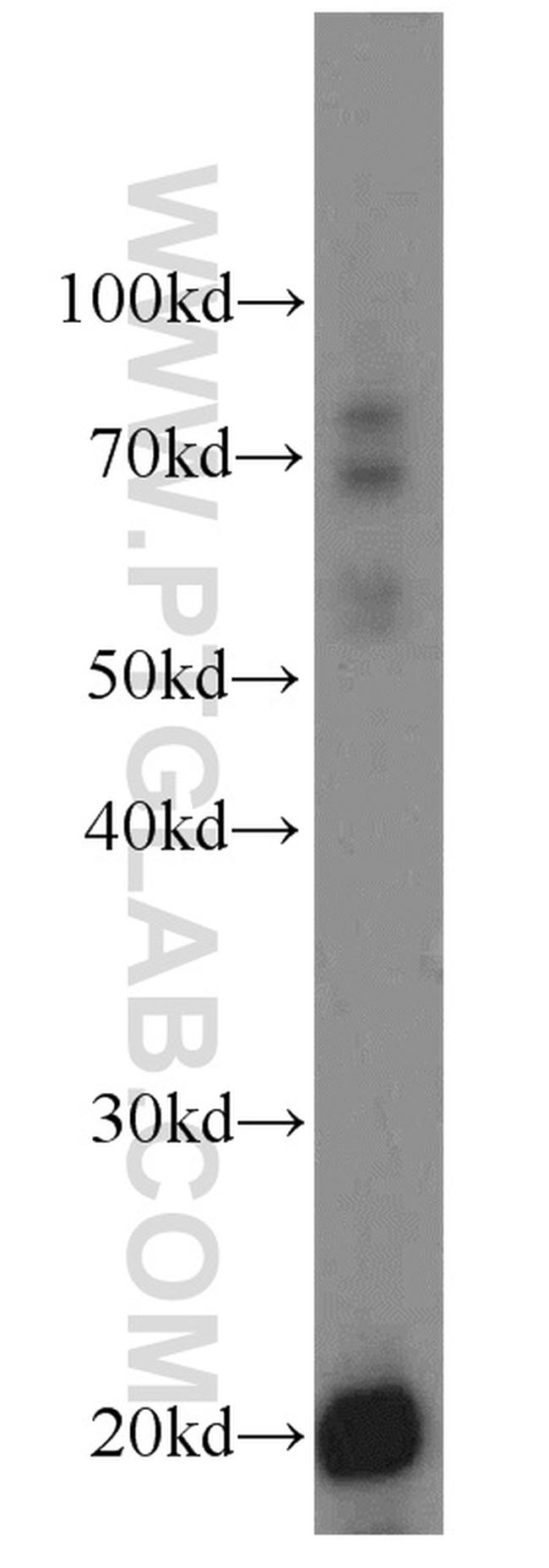 TMEM27 Antibody in Western Blot (WB)