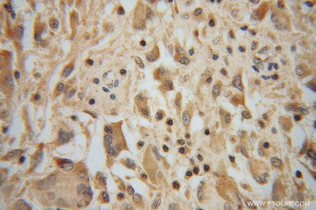 PPM1K Antibody in Immunohistochemistry (Paraffin) (IHC (P))