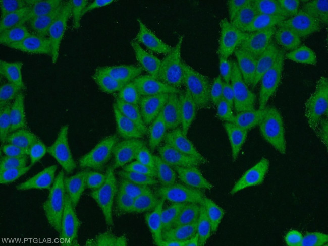ERI1 Antibody in Immunocytochemistry (ICC/IF)