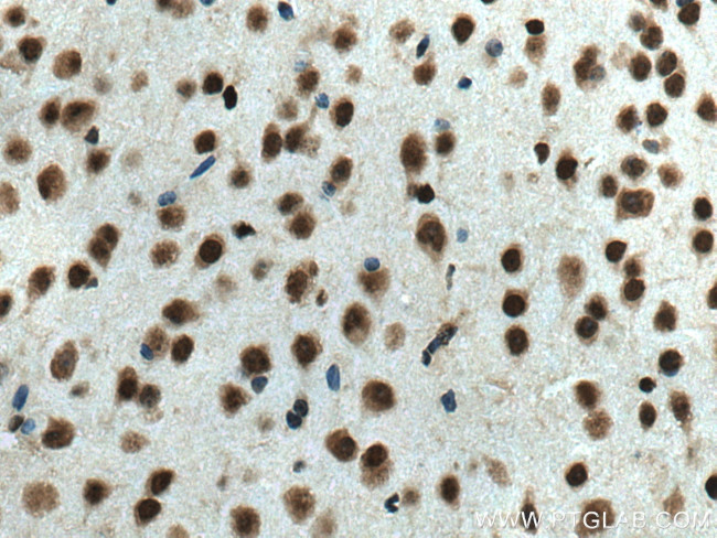HMGB2 Antibody in Immunohistochemistry (Paraffin) (IHC (P))