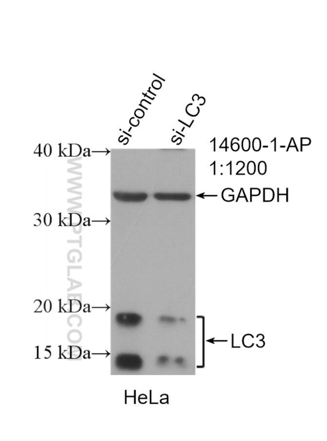 Lc3 Ip LC3 Polyclonal Antibody | Invitrogen (14600-1-AP)