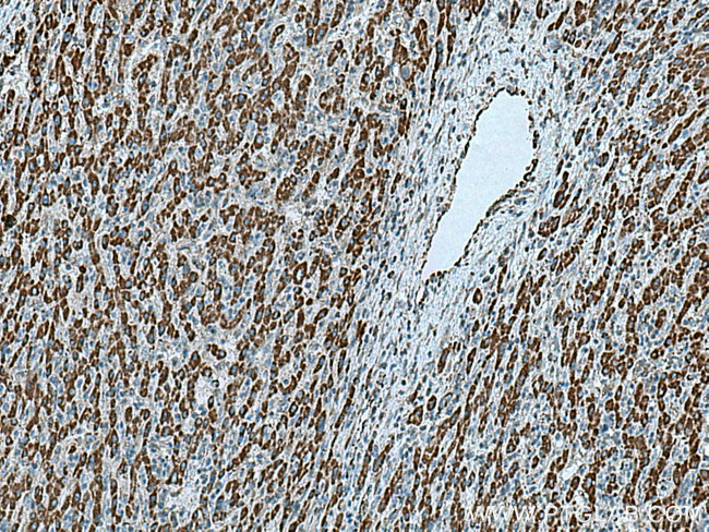 HIBCH Antibody in Immunohistochemistry (Paraffin) (IHC (P))