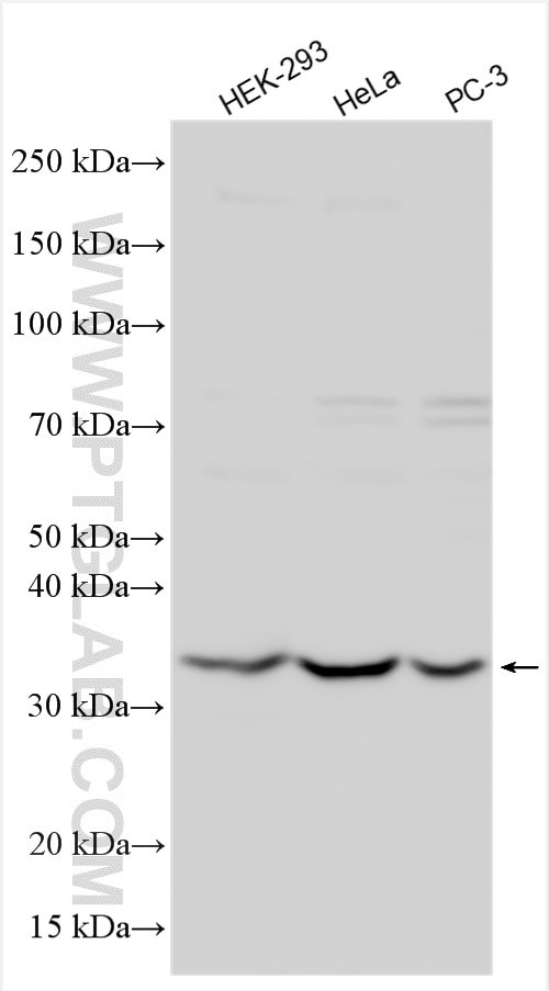 FRG1 Antibody in Western Blot (WB)