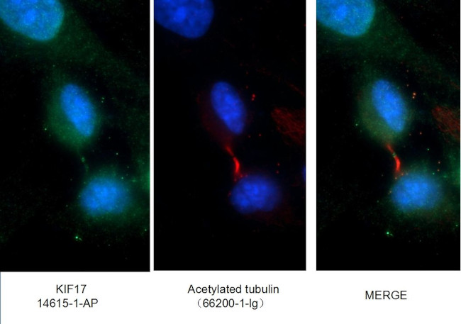 KIF17 Antibody in Immunocytochemistry (ICC/IF)