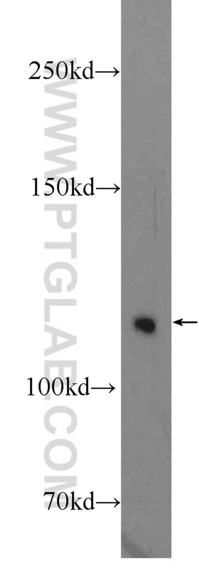 TUBGCP5 Antibody in Western Blot (WB)