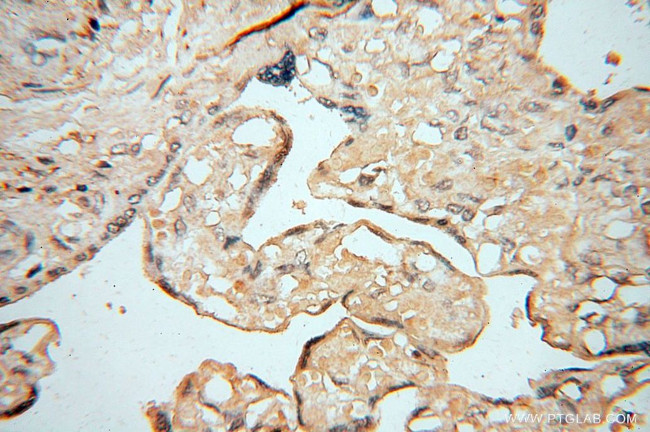 AKAP14 Antibody in Immunohistochemistry (Paraffin) (IHC (P))