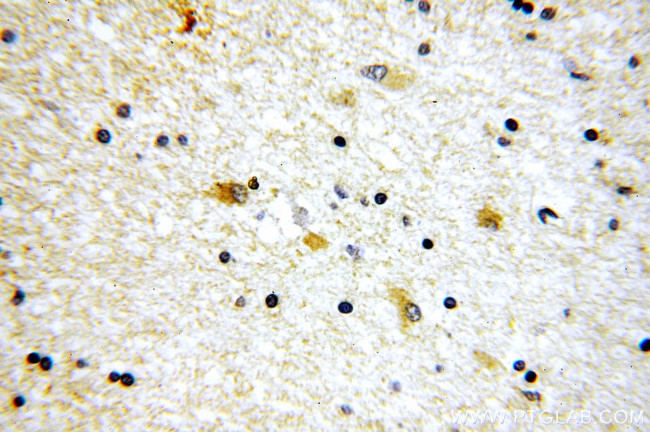 SV2B Antibody in Immunohistochemistry (Paraffin) (IHC (P))